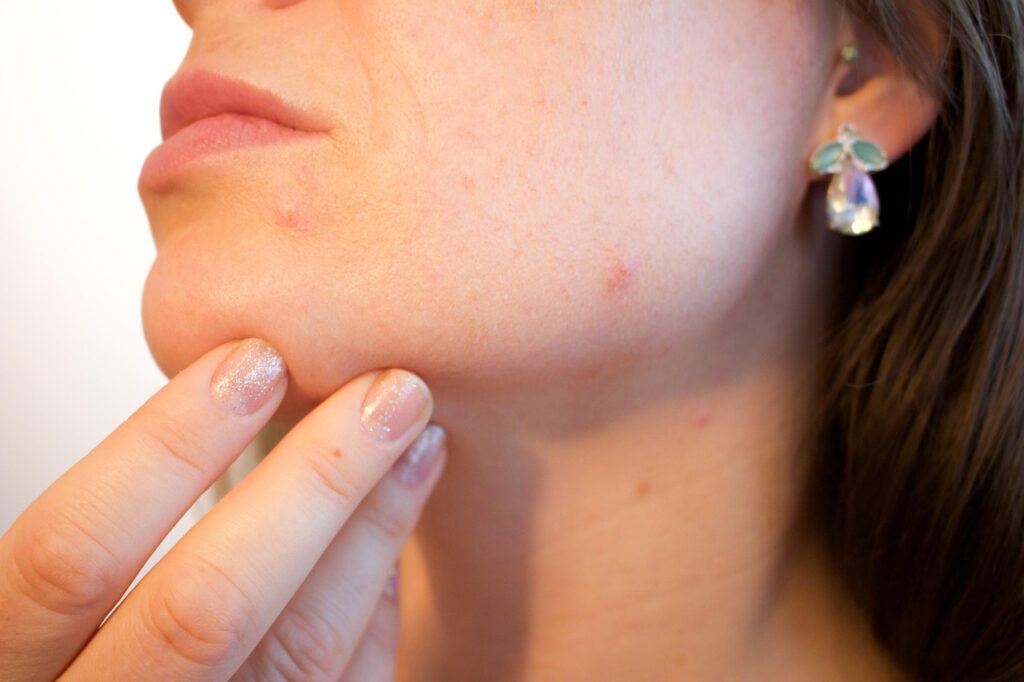 毛穴ケアを自宅で行うための効果的な方法は？