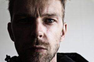 医療脱毛の痛みレベルはどれくらい？