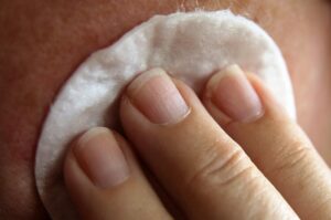 脱毛後のスキンケアに最適なおすすめアイテムは？