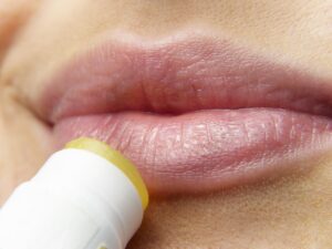 脱毛後の美肌ケアに必要なアイテムは何？
